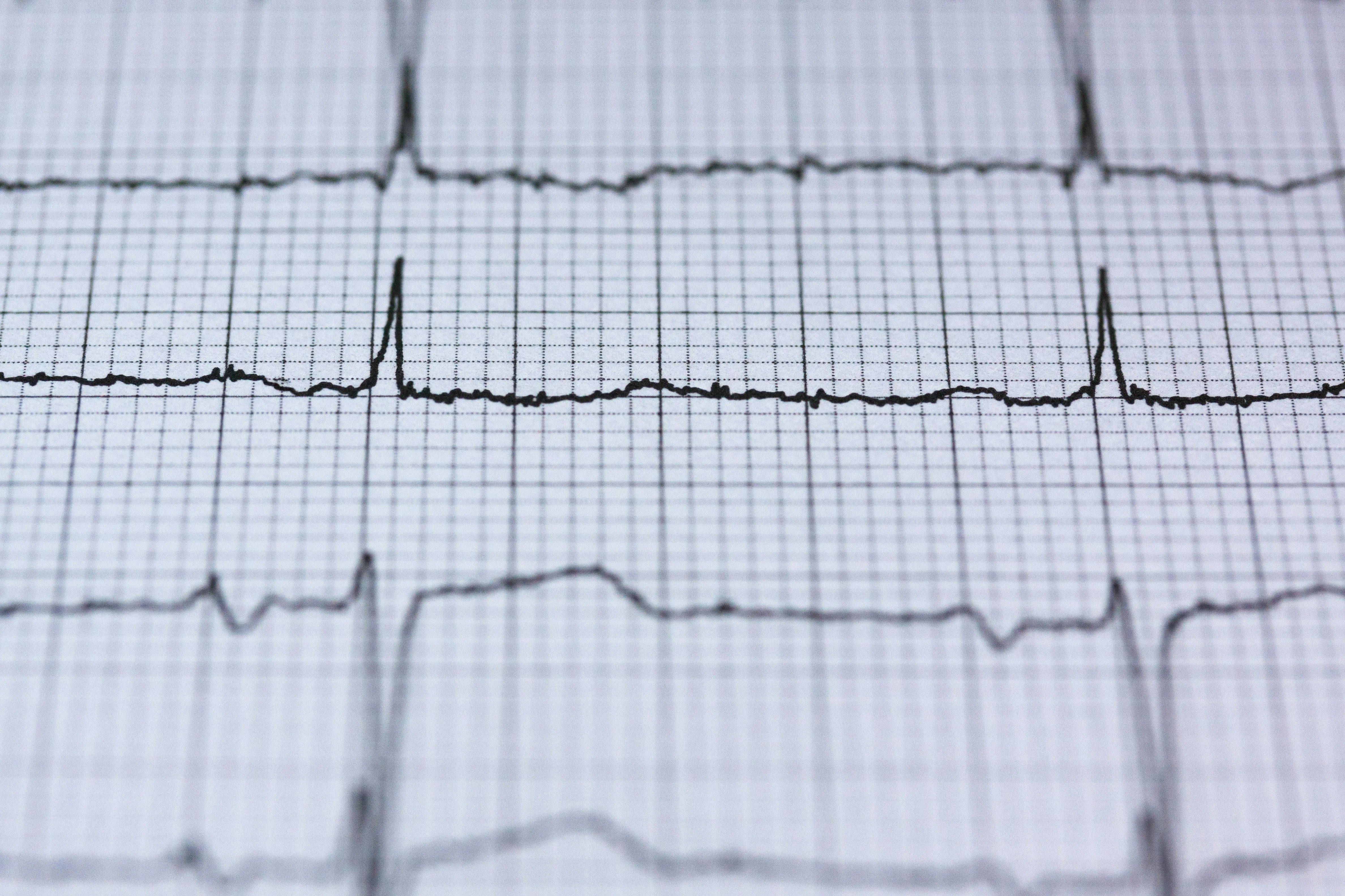 cohérence cardiaque
